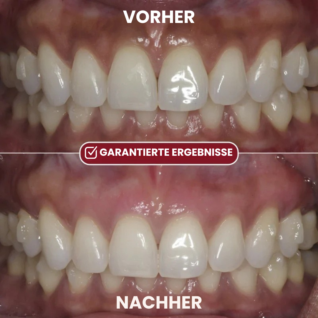 Depura – Rotes-Licht-Therapie-System