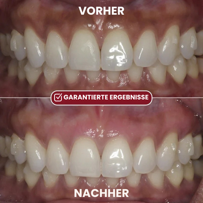 Depura – Rotes-Licht-Therapie-System