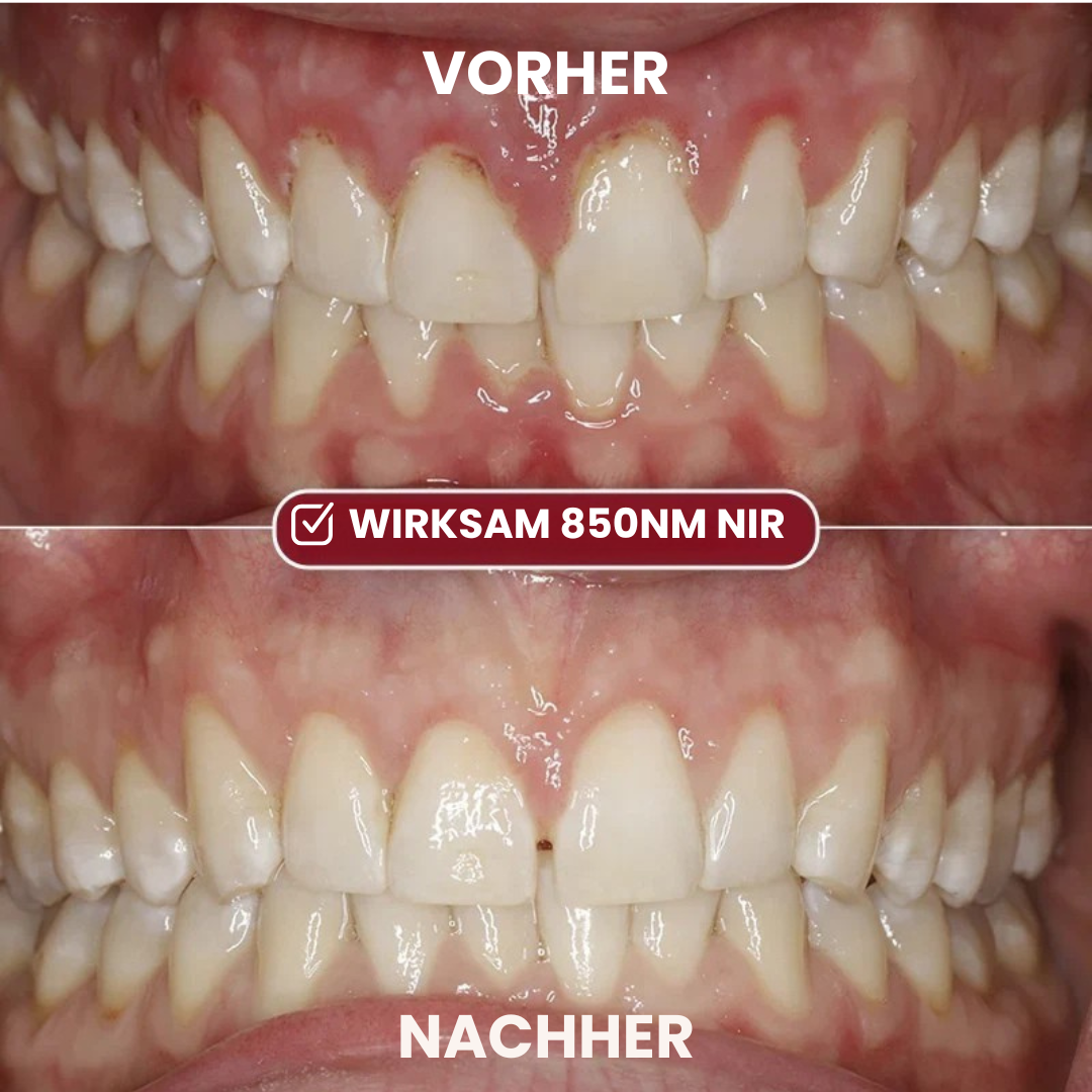 Depura – Rotes-Licht-Therapie-System